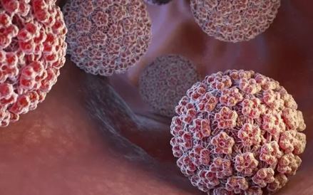 انکار وزارت بهداشت مقابل شیوع بالای HPV در ایران / از هر 10 نفر، ۷ نفر اچ‌پی‌وی مثبت دارند! / فروش واکسن 16 میلیونی گارداسیل در بازار آزاد