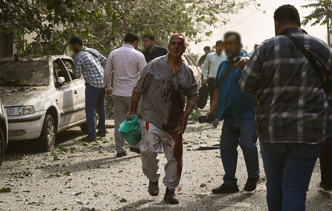 زخم جنگ بر تن ۵۷۵۰ ایرانی / از مجروحان جنگ ۱۲ روزه چه می دانیم؟